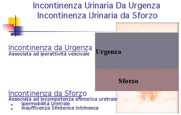 Incontinenza urinaria da urgenza - incontinenza urinaria da sforzo